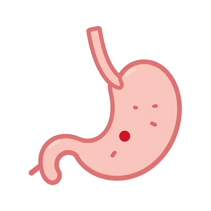 Stomach ulcer